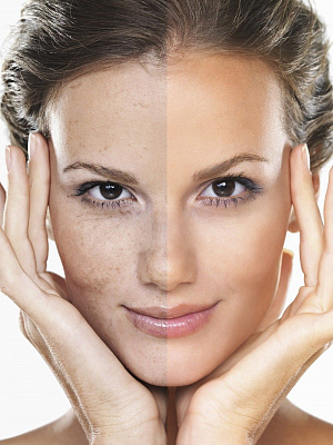 Пилинг лица. Ultra Подарки Оренбург. Подарочный сертификат на натуральную пилинг лица. Ultra Подарки Оренбург. 8 800-505-9503. Пилинг лица  #вМоскве#, чистка лица, очищение лица, химический пилинг